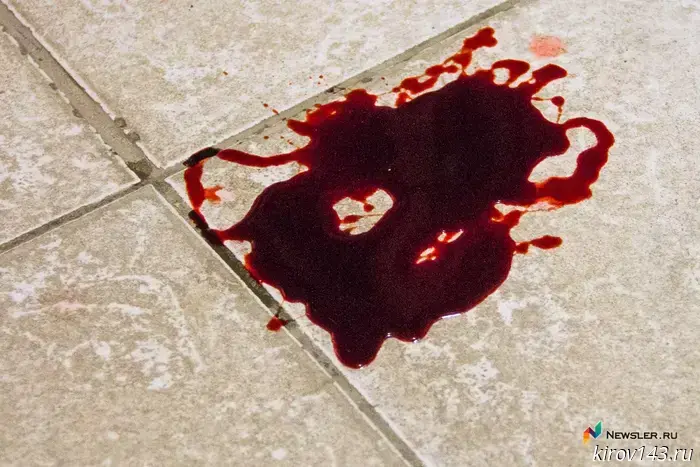 In Yuryansky District, a worker was injured when a hydraulic crane fell.