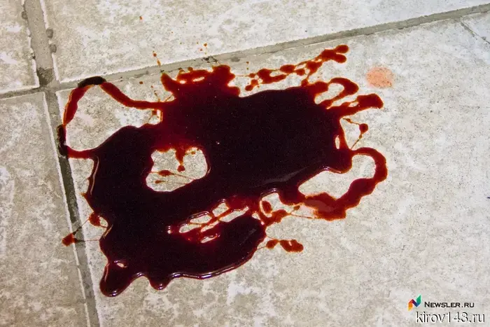 In the Omutninsky district, a worker smashed his face against concrete.