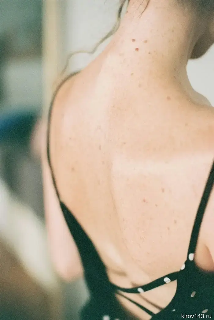 On Saturday, residents of Kirov will have their moles examined.