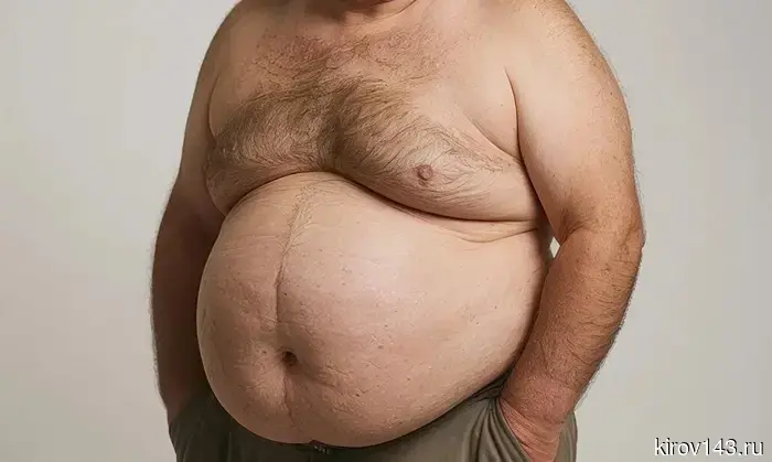 Хирургическая помощь для россиян с ожирением стала доступна в рамках обязательного медицинского страхования.