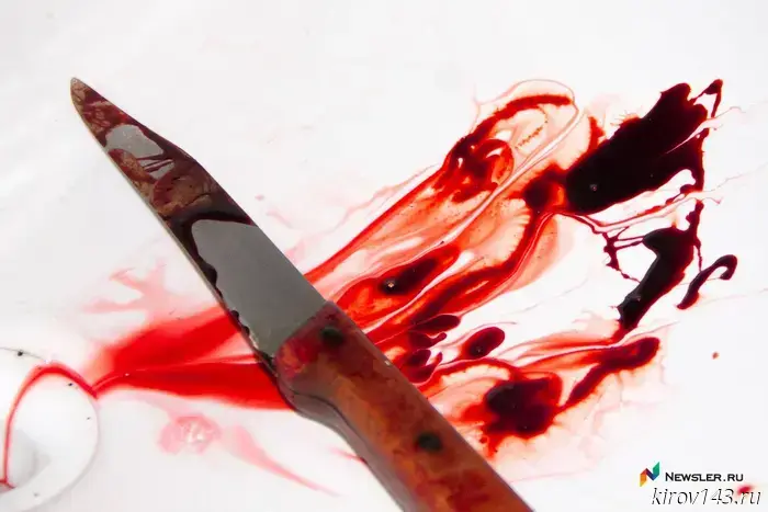 In the Kilmetsky district, a man stabbed an acquaintance.