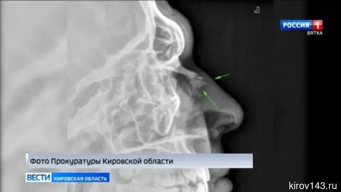 Обзор происшествий Кировской области