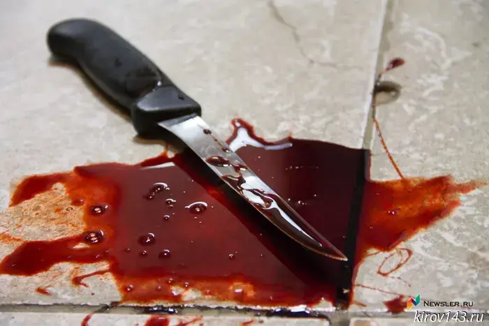Attempted murder in Afanasyevsky district: a man stabbed his roommate's son with a knife