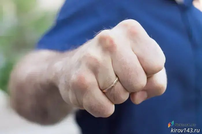 A resident of Kirov was seriously beaten because of a silver bracelet.