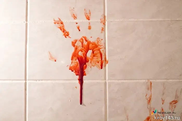 In Vyatskie Polyany, a man stabbed an acquaintance.